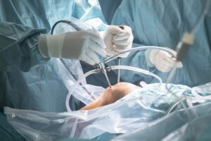 Critical Role Of Orthopedic Surgeons