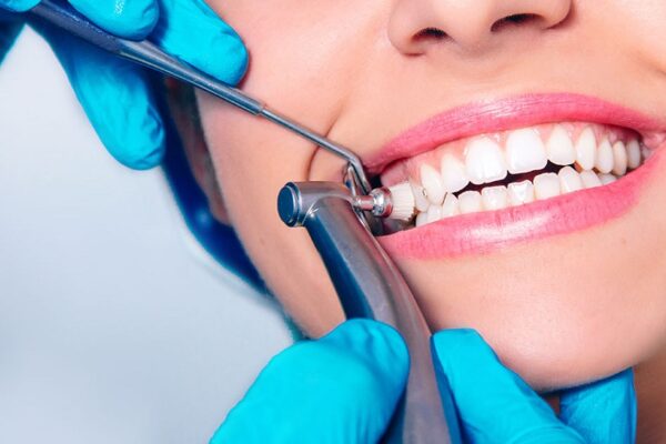 Dental Cleanings