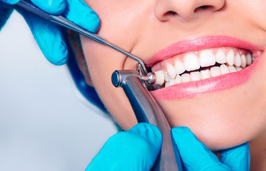 Dental Cleanings