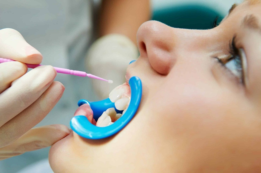 Protect your child's teeth